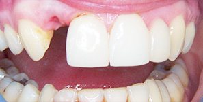 restorative dental treatments